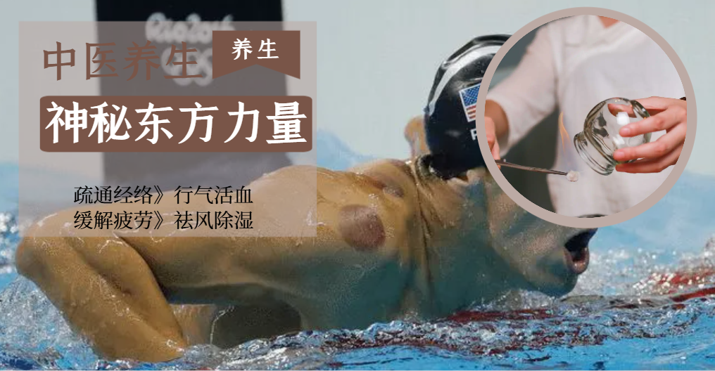 奥运赛场上的东方神秘力量：拔罐的奥秘与魅力